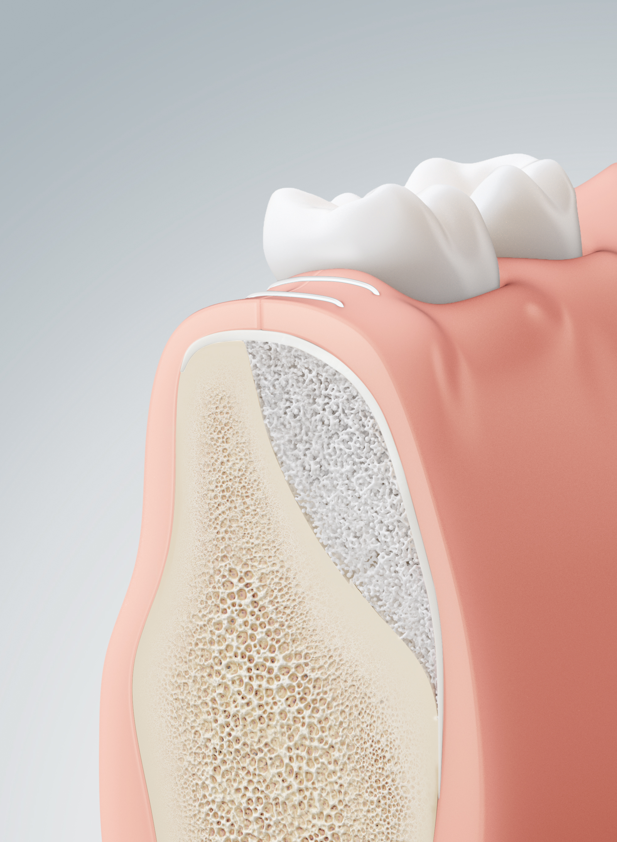 vorbehandlung-implantation